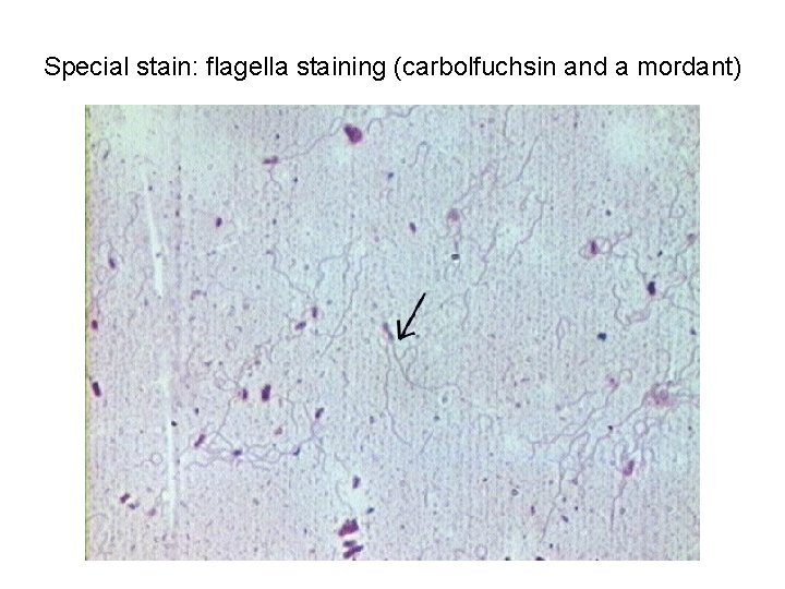 Special stain: flagella staining (carbolfuchsin and a mordant)  Special stain: flagella staining (carbolfuchsin and a mordant)