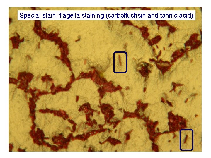 Special stain: flagella staining (carbolfuchsin and tannic acid)  Special stain: flagella staining (carbolfuchsin and tannic acid)