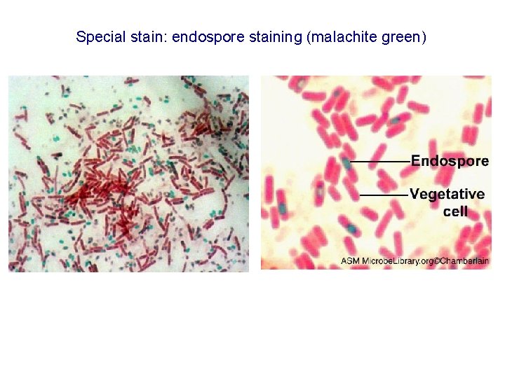Special stain: endospore staining (malachite green)  Special stain: endospore staining (malachite green)