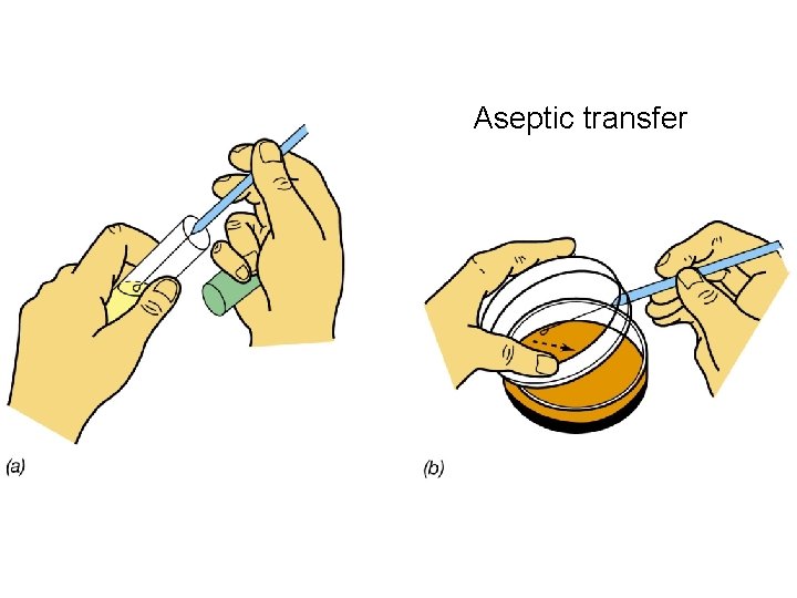 Aseptic transfer  Aseptic transfer
