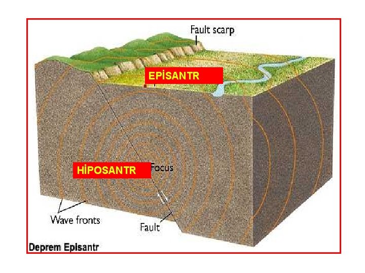 EPİSANTR HİPOSANTR 