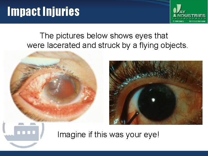Impact Injuries The pictures below shows eyes that were lacerated and struck by a
