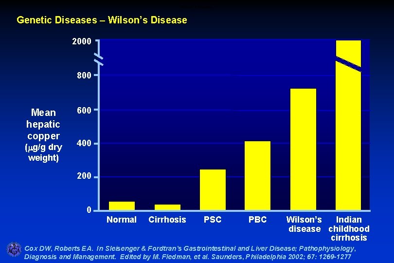 Wilson’s Disease Genetic Diseases – Wilson’s Disease 2000 800 Mean hepatic copper (mg/g dry Wilson’s Disease Genetic Diseases – Wilson’s Disease 2000 800 Mean hepatic copper (mg/g dry