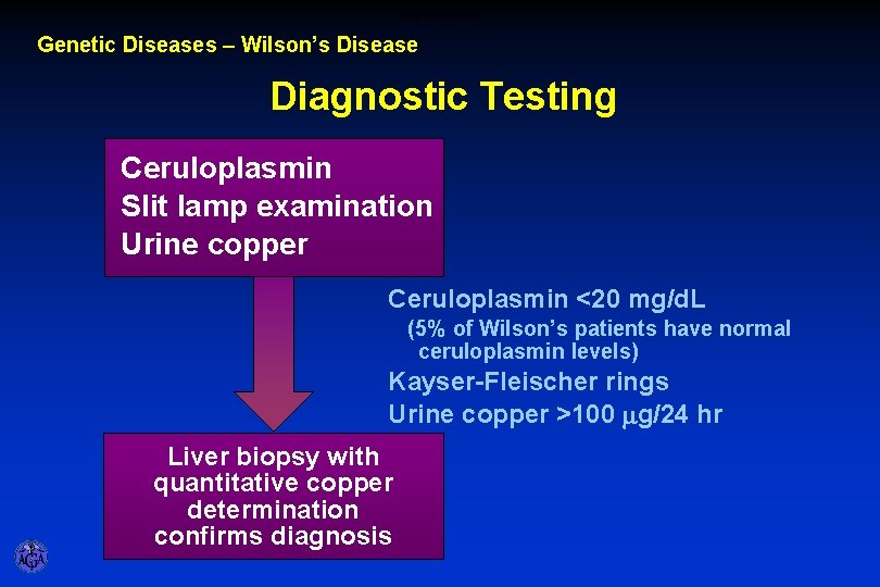 Diagnostic Testing Genetic Diseases – Wilson’s Disease Diagnostic Testing Ceruloplasmin Slit lamp examination Urine