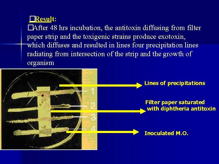 �Result: �After 48 hrs incubation, the antitoxin diffusing from filter paper strip and the