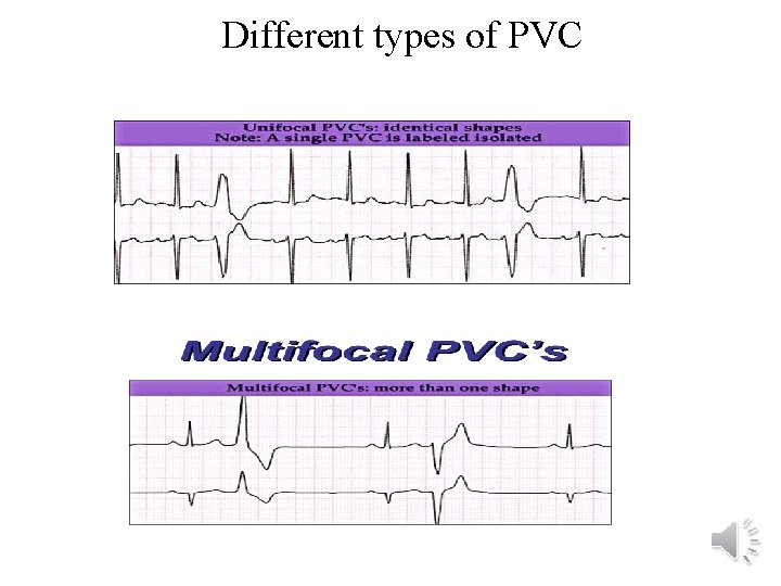 Different types of PVC 