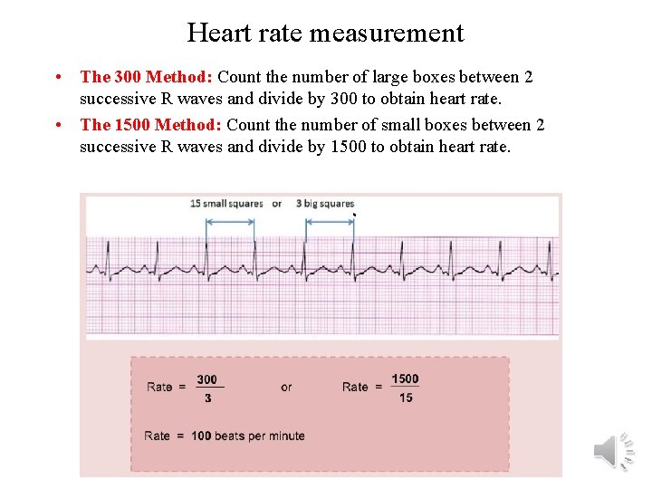 Heart rate measurement • The 300 Method: Count the number of large boxes between
