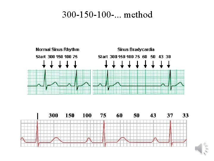 300 -150 -100 -. . . method 