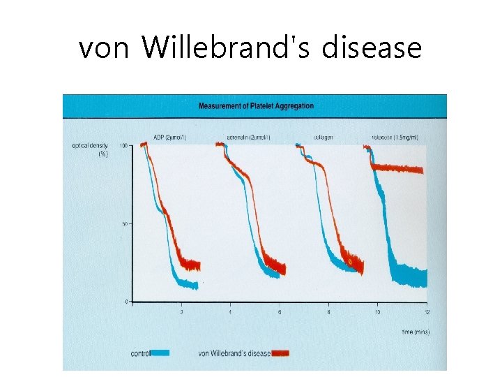 von Willebrand's disease 