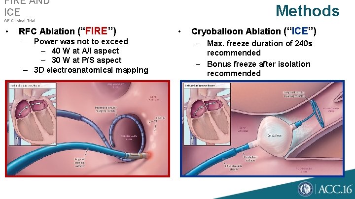FIRE AND ICE Methods AF Clinical Trial • RFC Ablation (“FIRE”) – Power was