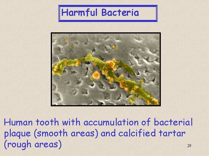 Harmful Bacteria Human tooth with accumulation of bacterial plaque (smooth areas) and calcified tartar