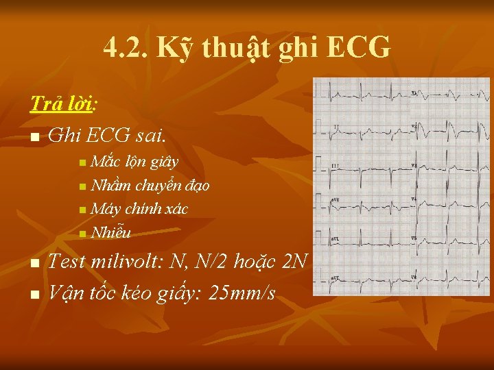 4. 2. Kỹ thuật ghi ECG Trả lời: n Ghi ECG sai. Mắc lộn
