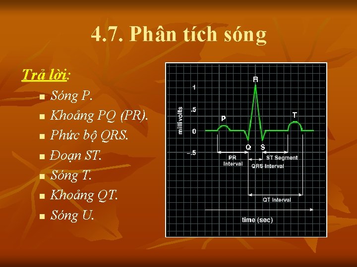 4. 7. Phân tích sóng Trả lời: n n n n Sóng P. Khoảng