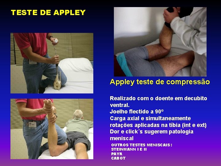 TESTE DE APPLEY Appley teste de compressão Realizado com o doente em decubito ventral.