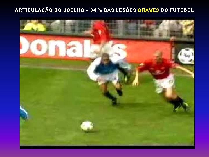 ARTICULAÇÃO DO JOELHO – 34 % DAS LESÕES GRAVES DO FUTEBOL 