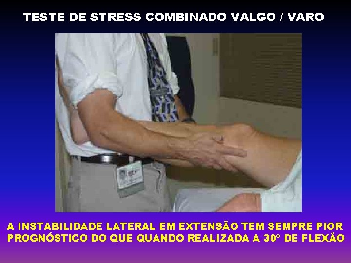 TESTE DE STRESS COMBINADO VALGO / VARO A INSTABILIDADE LATERAL EM EXTENSÃO TEM SEMPRE