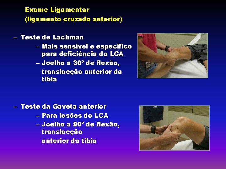 Exame Ligamentar (ligamento cruzado anterior) – Teste de Lachman – Mais sensível e específico