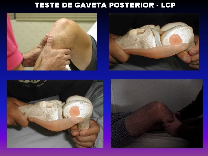 TESTE DE GAVETA POSTERIOR - LCP 