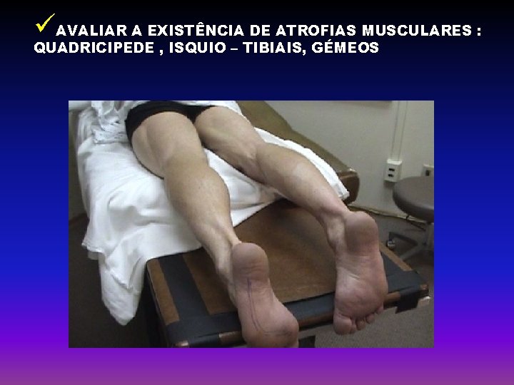 üAVALIAR A EXISTÊNCIA DE ATROFIAS MUSCULARES : QUADRICIPEDE , ISQUIO – TIBIAIS, GÉMEOS 