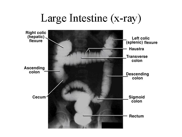 Large Intestine (x-ray) 