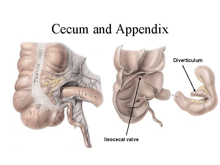 Cecum and Appendix Diverticulum Ileocecal valve 