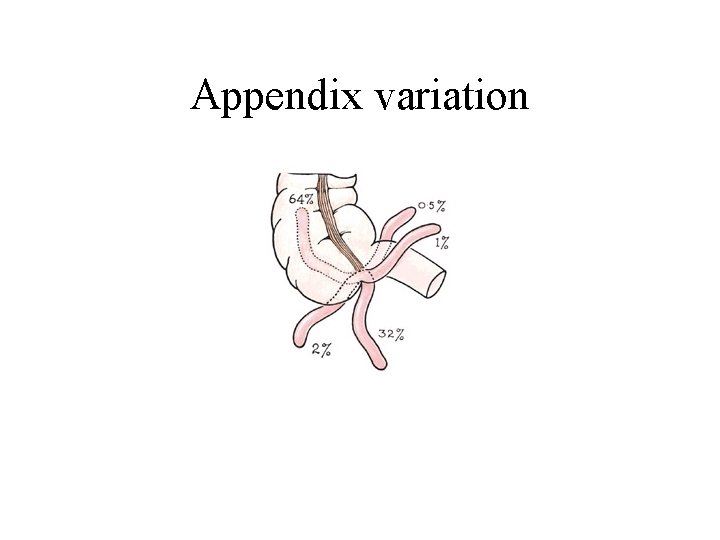 Appendix variation 