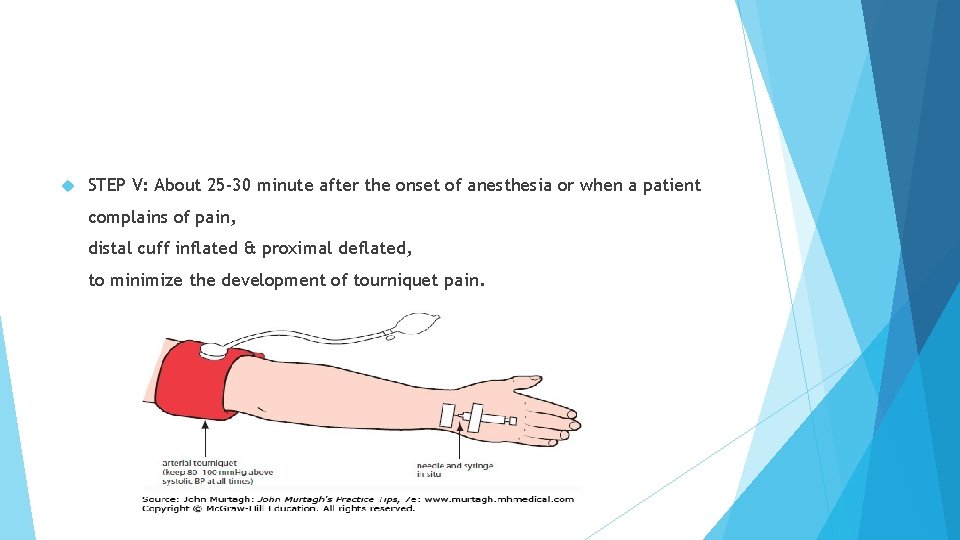  STEP V: About 25 -30 minute after the onset of anesthesia or when