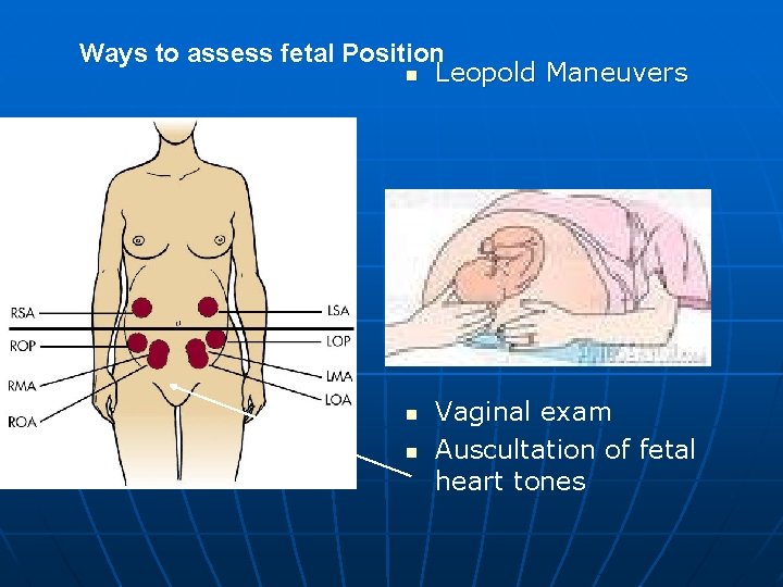 Ways to assess fetal Position n Leopold Maneuvers n n Vaginal exam Auscultation of