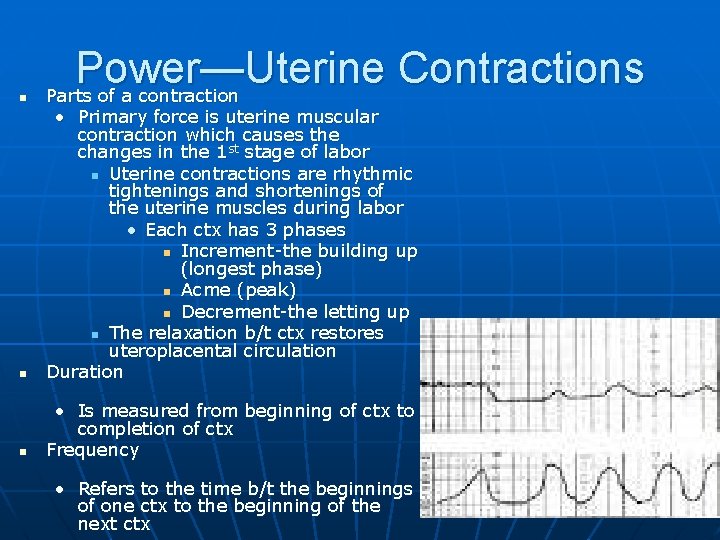 n Power—Uterine Contractions Parts of a contraction n • Primary force is uterine muscular