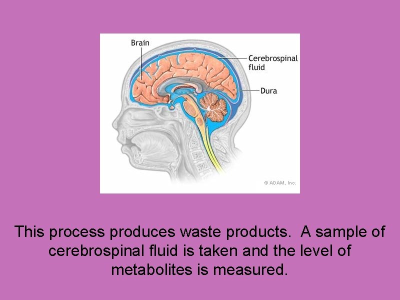 This process produces waste products. A sample of cerebrospinal fluid is taken and the
