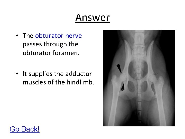 Answer • The obturator nerve passes through the obturator foramen. • It supplies the