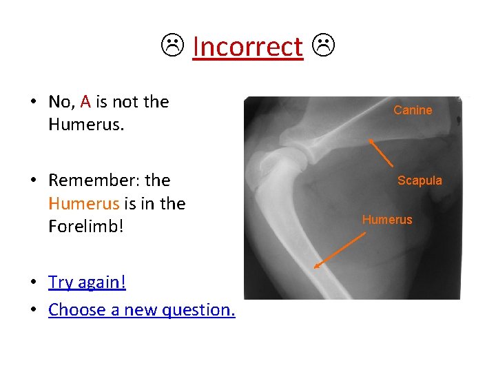  Incorrect • No, A is not the Humerus. • Remember: the Humerus is