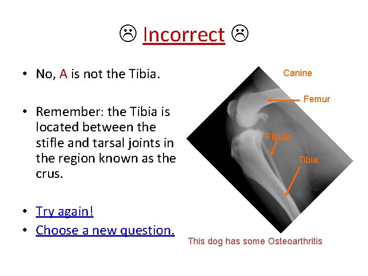  Incorrect • No, A is not the Tibia. • Remember: the Tibia is