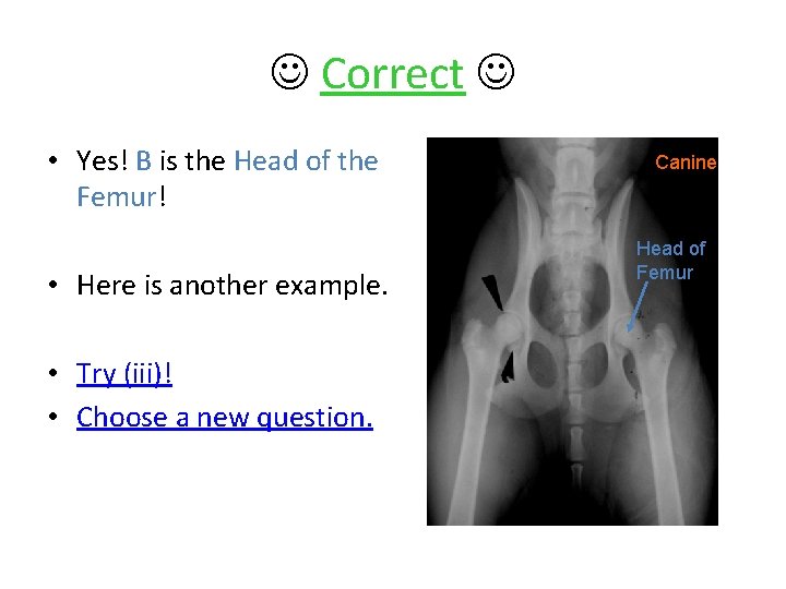  Correct • Yes! B is the Head of the Femur! • Here is