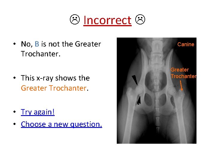  Incorrect • No, B is not the Greater Trochanter. • This x-ray shows