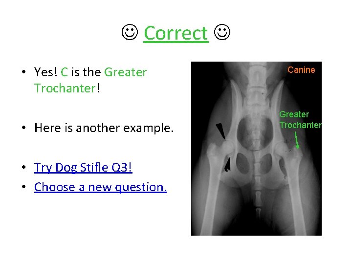  Correct • Yes! C is the Greater Trochanter! • Here is another example.
