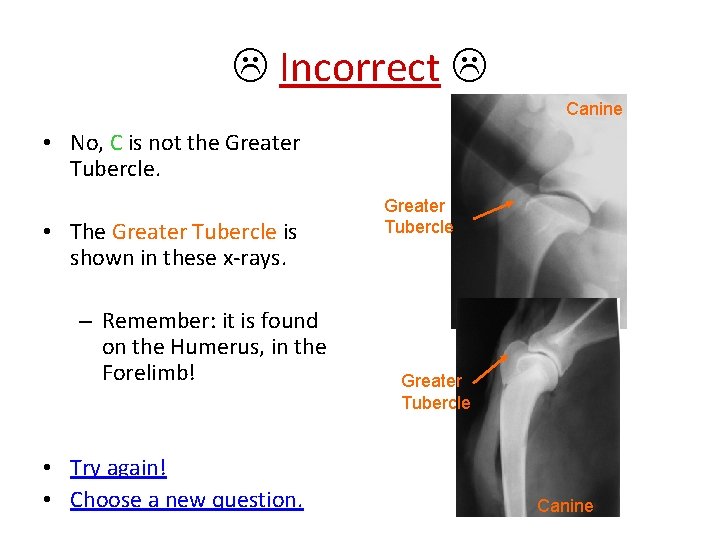  Incorrect Canine • No, C is not the Greater Tubercle. • The Greater