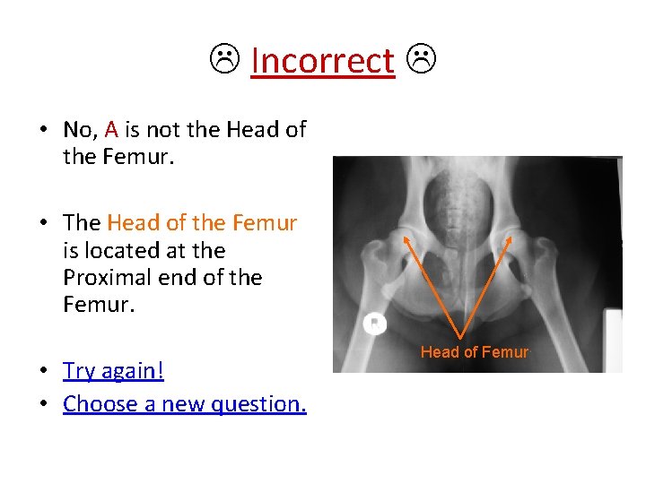  Incorrect • No, A is not the Head of the Femur. • The