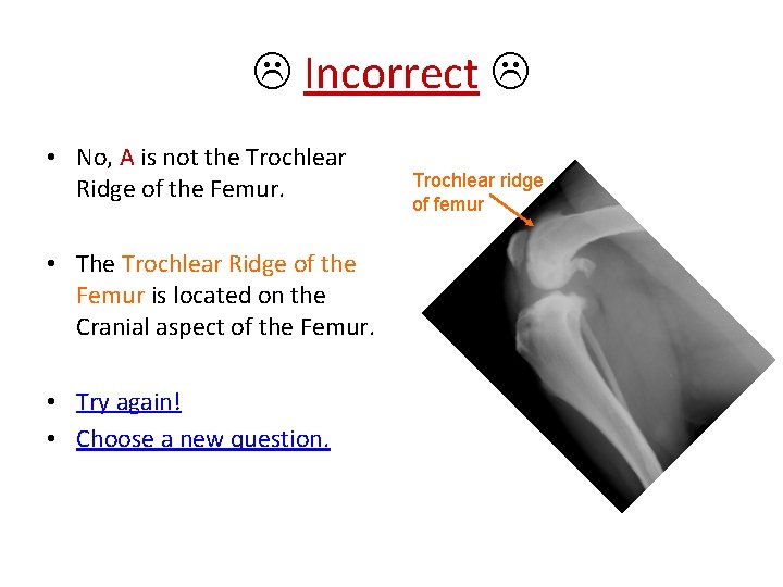  Incorrect • No, A is not the Trochlear Ridge of the Femur. •