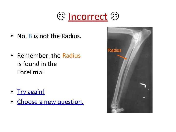  Incorrect • No, B is not the Radius. • Remember: the Radius is