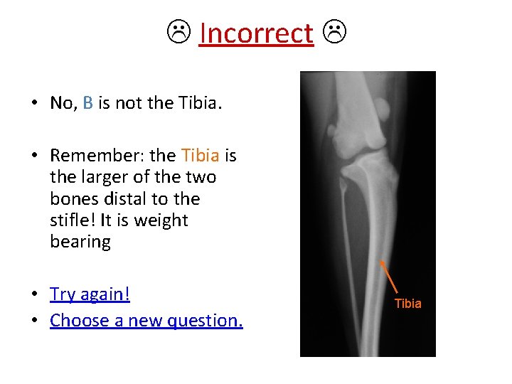  Incorrect • No, B is not the Tibia. • Remember: the Tibia is