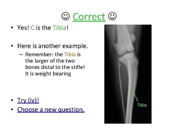  Correct • Yes! C is the Tibia! • Here is another example. –