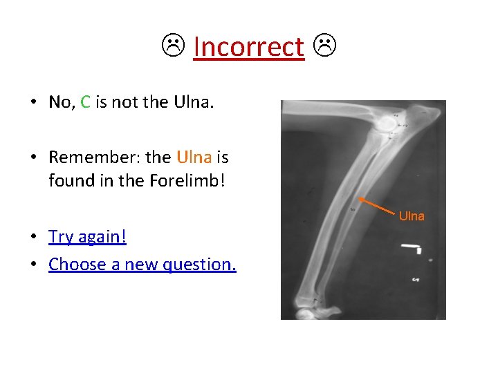  Incorrect • No, C is not the Ulna. • Remember: the Ulna is