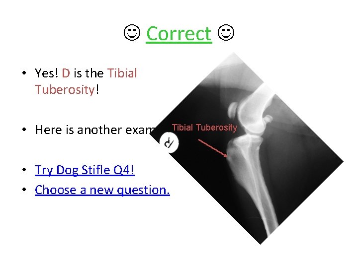  Correct • Yes! D is the Tibial Tuberosity! • Here is another example.