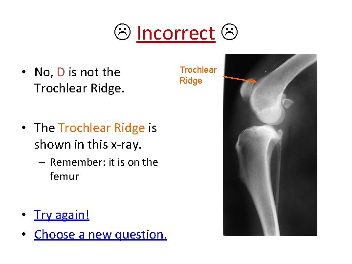  Incorrect • No, D is not the Trochlear Ridge. • The Trochlear Ridge