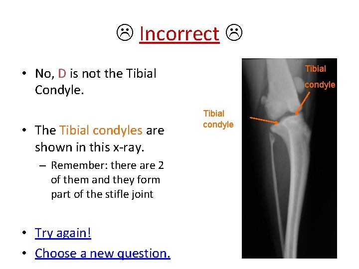  Incorrect Tibial • No, D is not the Tibial Condyle. • The Tibial