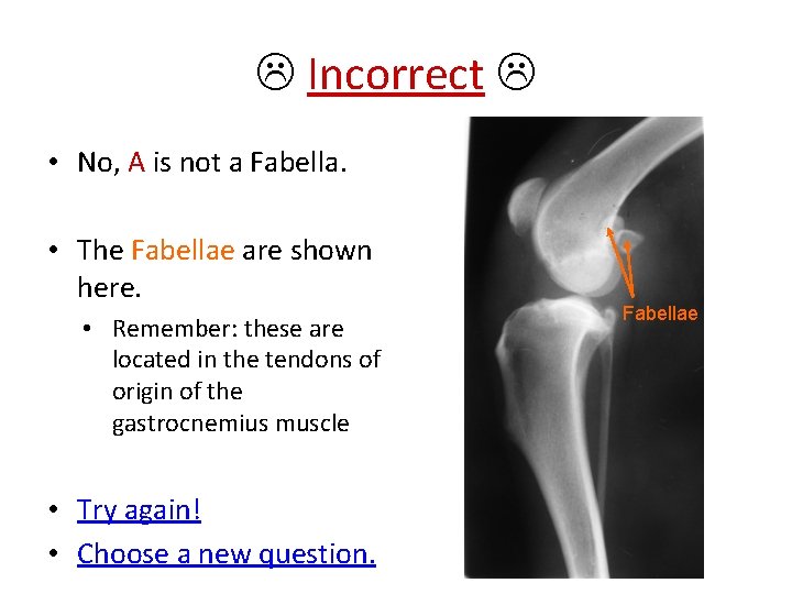  Incorrect • No, A is not a Fabella. • The Fabellae are shown