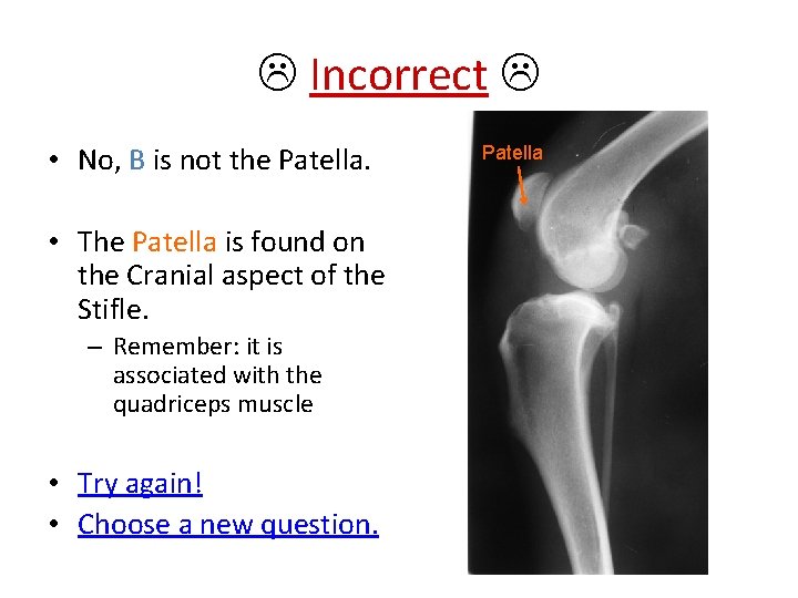  Incorrect • No, B is not the Patella. • The Patella is found