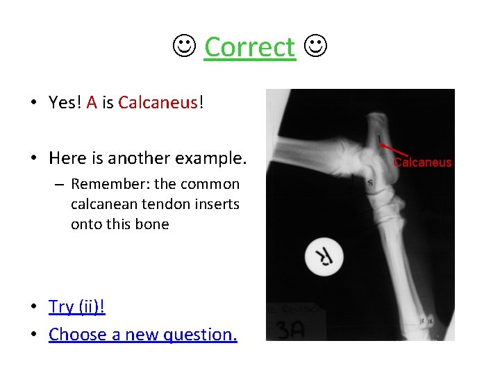  Correct • Yes! A is Calcaneus! • Here is another example. – Remember: