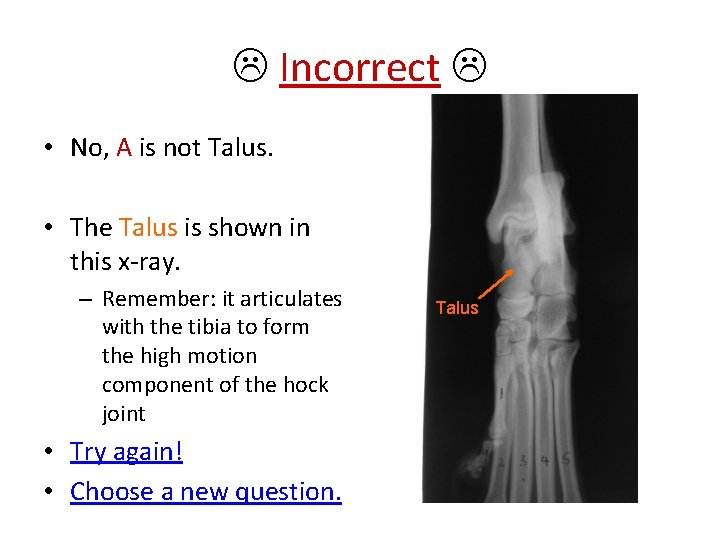  Incorrect • No, A is not Talus. • The Talus is shown in